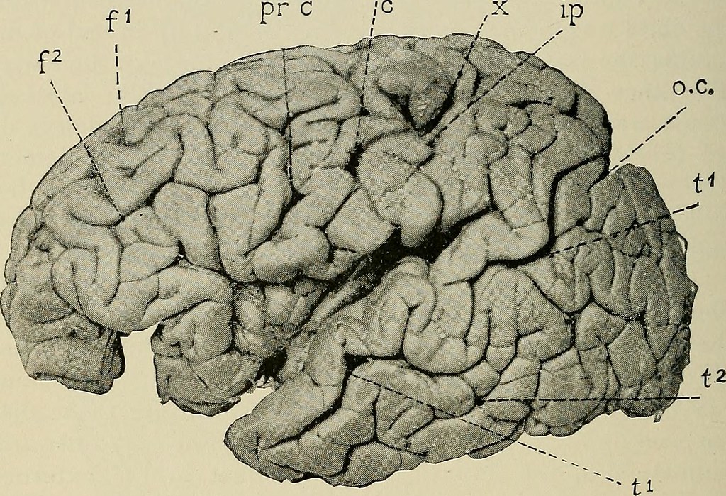 Apple’s Memory Integrity Enforcement